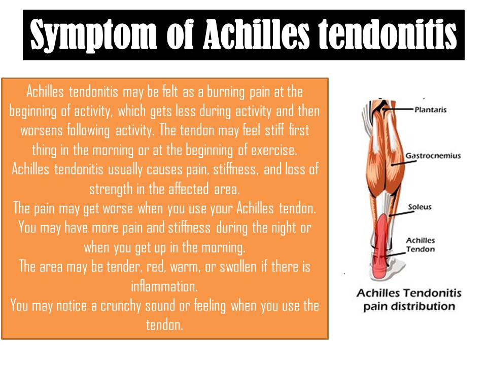 Achilles on sale tendon burning