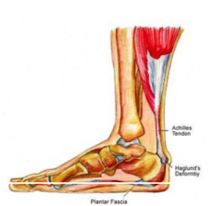 ankle pain treatment singapore