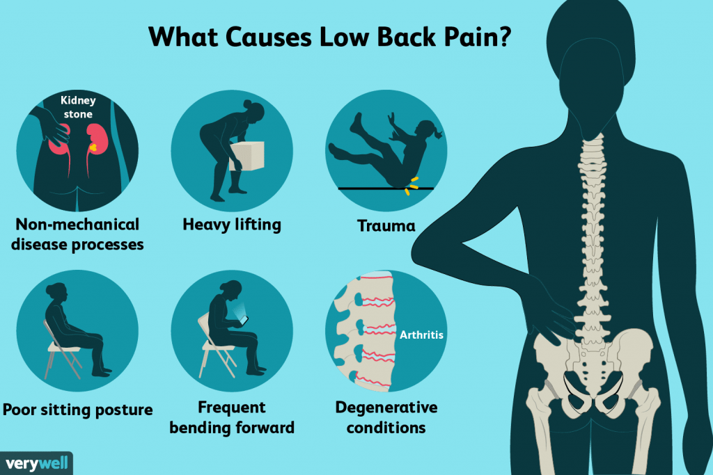 an-overview-of-low-back-pain-causes-risk-factors-and-treatment