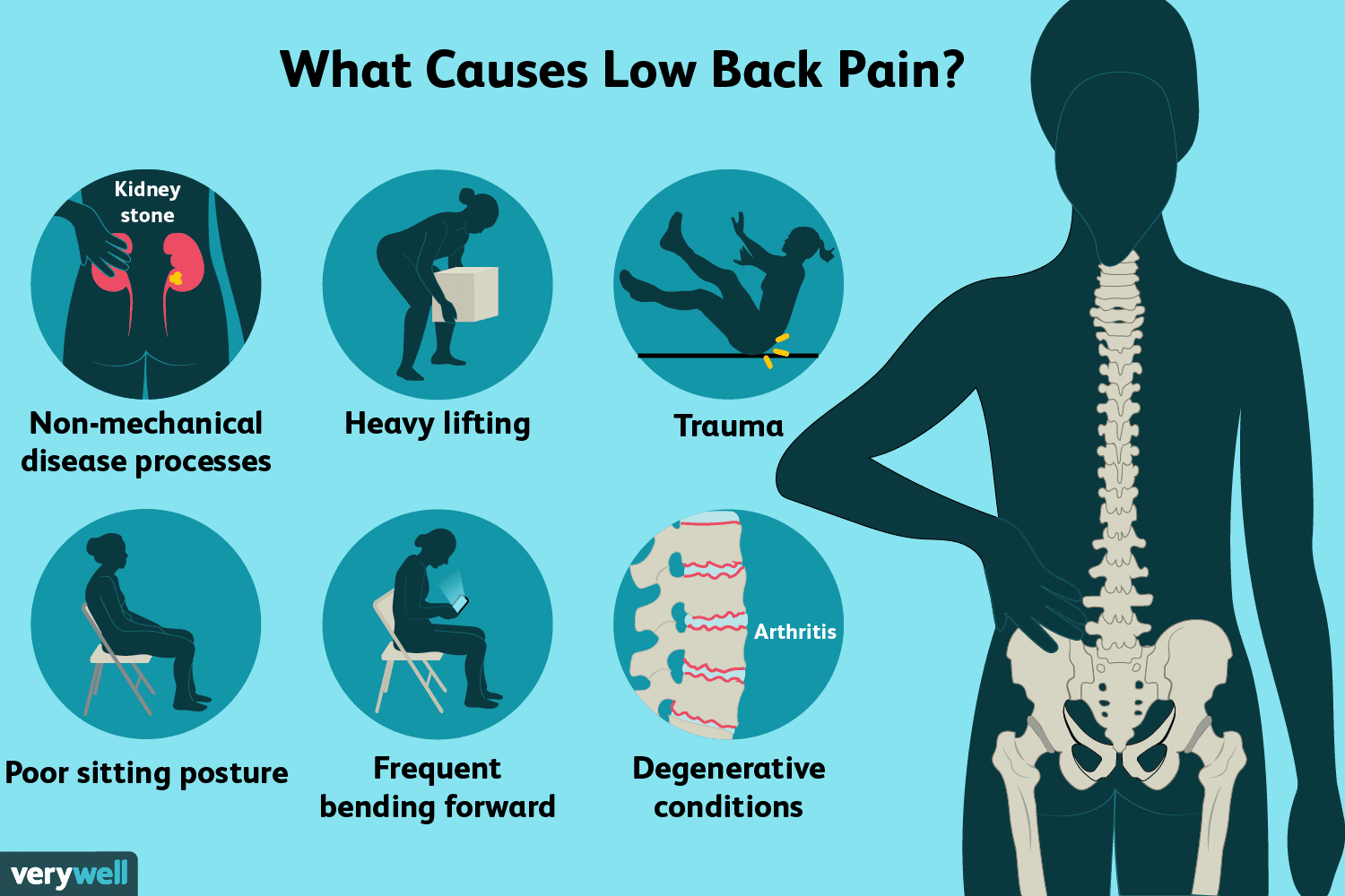 Single side lower back pain