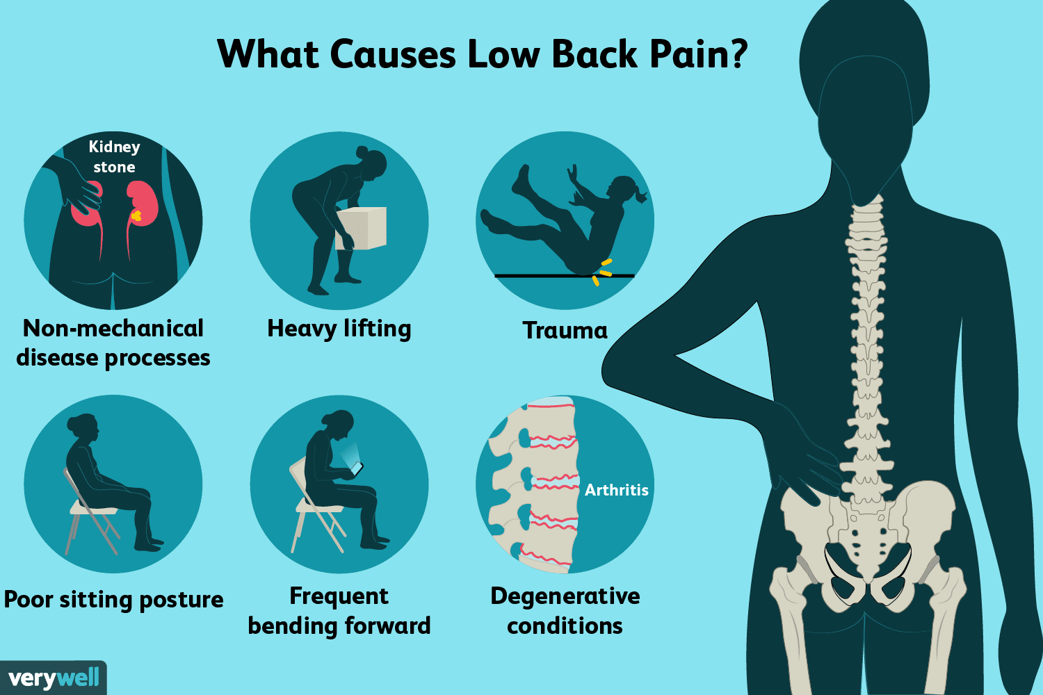 Does Back Pain Affect The Legs